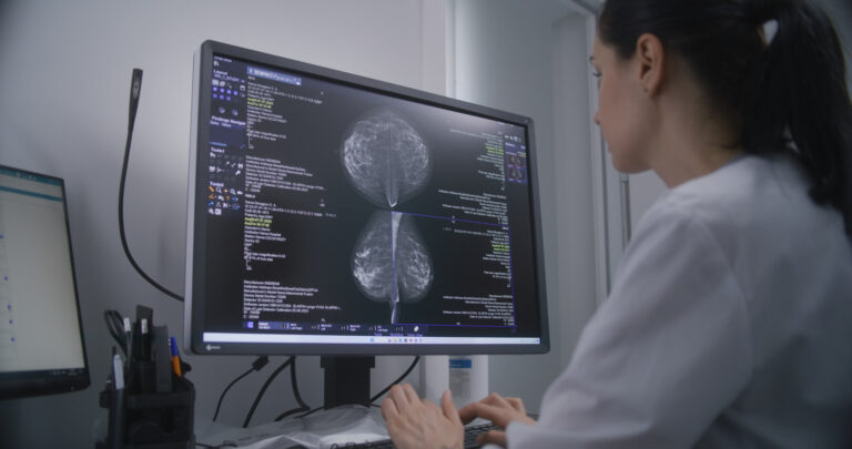 Technician examines results of mammography screening procedure using computer.