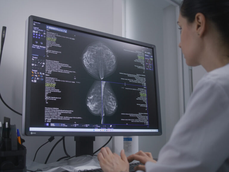 Technician examines results of mammography screening procedure using computer.