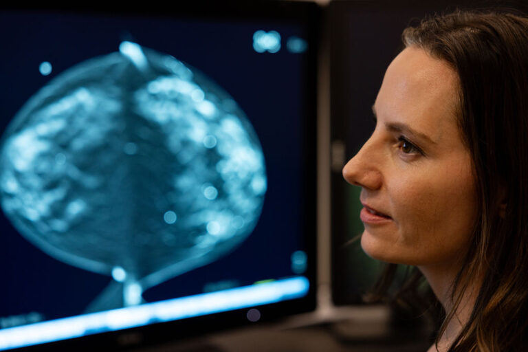Dr White closely observing a breast scan image displayed on a computer monitor in a medical setting.